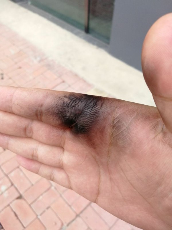 差点我就没了差点我就没了