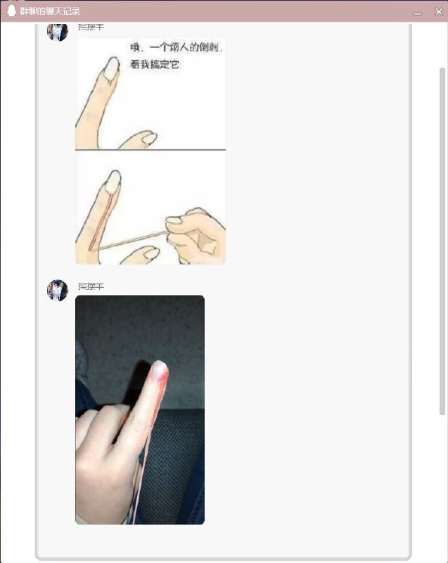 剧烈疼痛 受不了的不要看