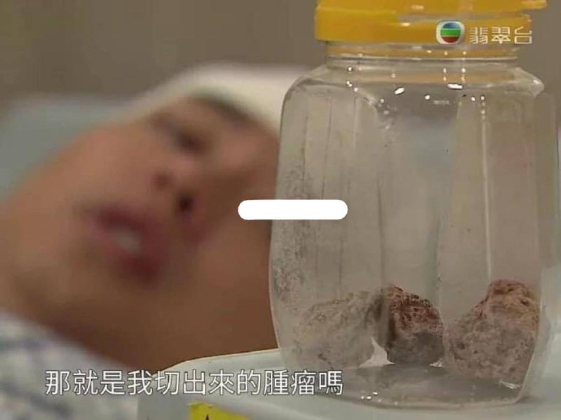 ’肿瘤’