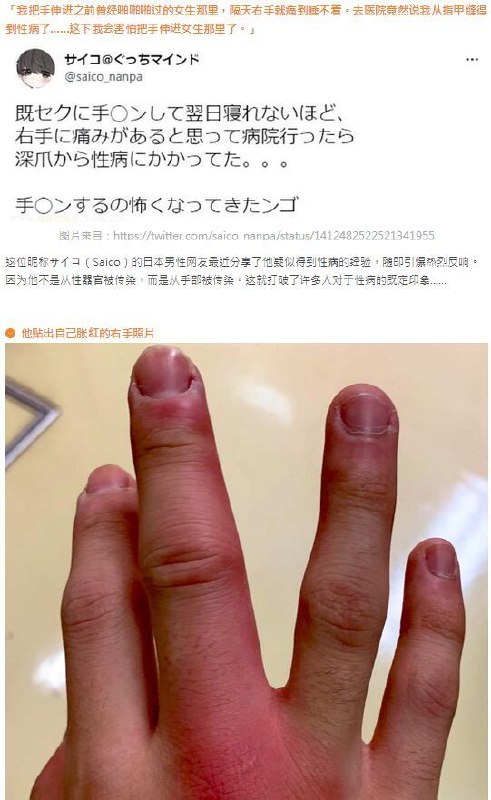via 沃龙