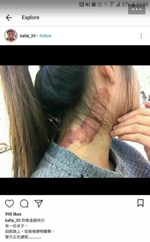 不明物体攻击 