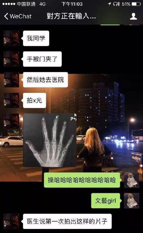 美甲后你的X光片会更美哦from 平壤卫视 via 呀美甲后你的X光片会更美哦from 平壤卫视 via 呀