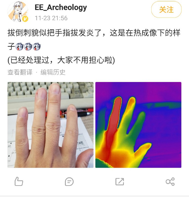 艹，这是继热成像看短路之后又一伟大用法，热成像看病from ㅤ
